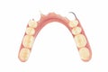 Old dentures isolated on white background Royalty Free Stock Photo