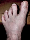 Old Dirty Human Foot Disfigured Royalty Free Stock Photo