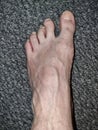 Old Dirty Human Foot Disfigured Royalty Free Stock Photo