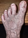 Old Dirty Human Foot Disfigured Royalty Free Stock Photo