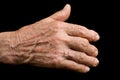 Old hand with arthritis Royalty Free Stock Photo