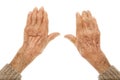 Old hands with artritis