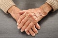 Old hands with artritis Royalty Free Stock Photo