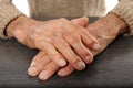 Old hands with artritis Royalty Free Stock Photo