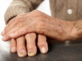 Old hands with artritis