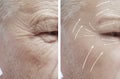 Old man face with wrinkles arrow before and after procedures Royalty Free Stock Photo