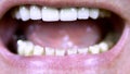 Old man shows teeth. The upper teeth are straight and the lower crooked. Man opened her mouth. close-up