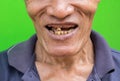 Old man smiling showing his teeth unattractive on green background.