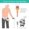 Old man urinating in urine filled bottle.