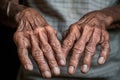 an old mans hands with wrinkled skin