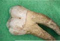 Old molars of humans