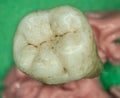 Old molars of humans