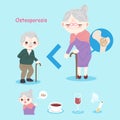 Old people with osteoporosis