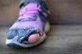 Old shoes with holes homeless toes sticking out Royalty Free Stock Photo