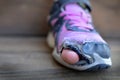 Old shoes with holes homeless toes sticking out Royalty Free Stock Photo