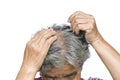 Old woman felt a lot of anxiety about hair loss issue