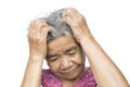 Old woman felt a lot of anxiety about hair loss and itching dandruff issue Royalty Free Stock Photo