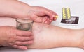 Old woman holding a glass of water and a pill for varicose veins on the background of the legs with varicose veins