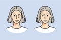 Old woman struggle with facial nerve palsy