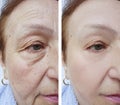 Old woman wrinkles before and after correction cosmetology treatments Royalty Free Stock Photo