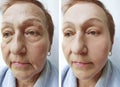 Old woman wrinkles before and after treatments Royalty Free Stock Photo