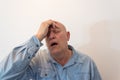 Older man hand to forehead in distress or pain, bald, alopecia, chemotherapy, cancer