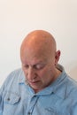 Older man looking down, bald, alopecia, chemotherapy, cancer