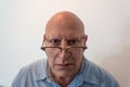 Older man looking over horn rimmed glasses, bald, alopecia, chemotherapy, cancer, on white