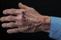 an older mans hand with a black background