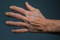 an older mans hand with wrinkled skin on it