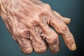 an older womans hand with wrinkled skin