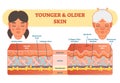 Older and younger skin comparison diagram, vector illustration scheme.