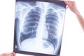 X-ray of lungs examining lung cancer