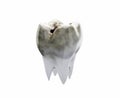 One dirty molar tooth