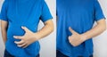 Before and after. In one half of the picture, the man clasped his swollen belly, and in the second, he shows that the problem is