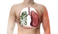 One lung consists of green leaves as metaphor healthy respiratory system Royalty Free Stock Photo