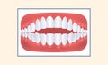 Open Bite Teeth Icon Against Yellow