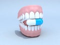 Open denture with pill