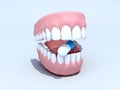 Open denture with pill