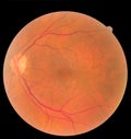 Ophthalmic image detailing the retina and optic nerve inside a healthy human eye. Health protection concept