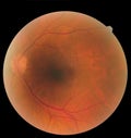 Ophthalmic image detailing the retina and optic nerve inside a healthy human eye. Health protection concept