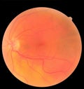 Ophthalmic image detailing the retina and optic nerve inside a healthy human eye. Health protection concept