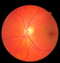 Ophthalmic image detailing the retina and optic nerve inside a healthy human eye. Medicine concept