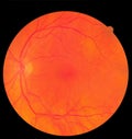 Ophthalmic image detailing the retina and optic nerve inside a healthy human eye. Medicine concept