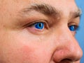 Ophthalmologist concept. Mans eye with contact lens, closeup. Man with blue eyes Royalty Free Stock Photo