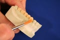 Oral Health Teeth Mold