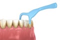 Oral hygiene: using toothpick dental floss to remove food stuck from teeth. Medically accurate dental 3D illustration