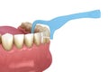 Oral hygiene: using toothpick dental floss to remove food stuck from teeth. Medically accurate dental 3D illustration