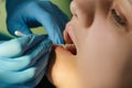 Oral procedure