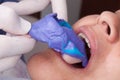 Oral rehabilitation process, partial removable prosthesis